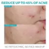La Roche-Posay Effaclar Salicylic Acid Acne Treatment to Minimize Pores 理膚寶水 精華液